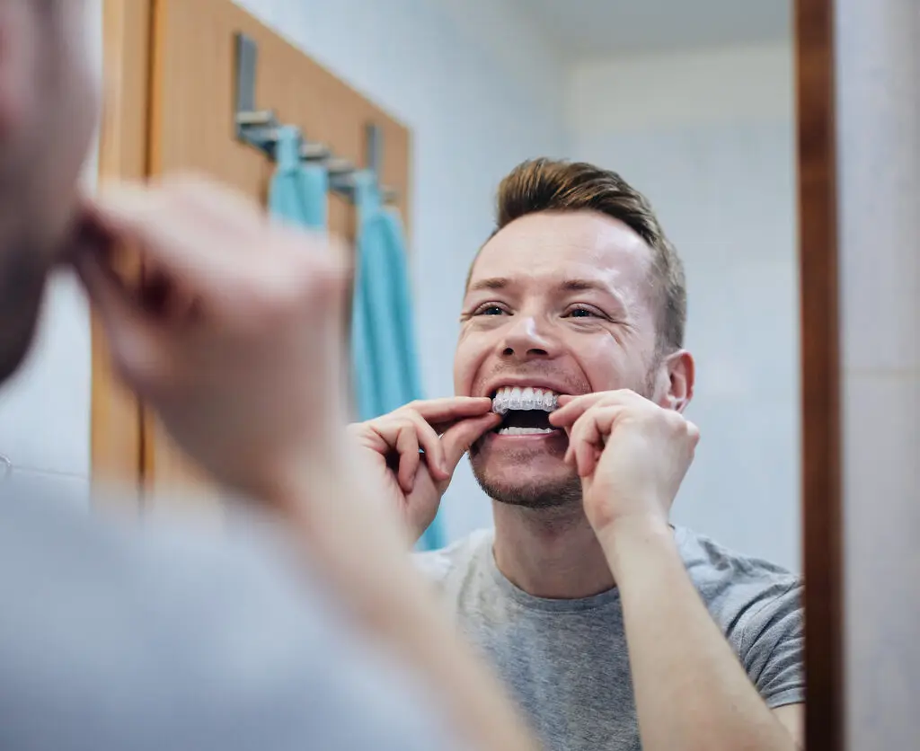at home dental aligners