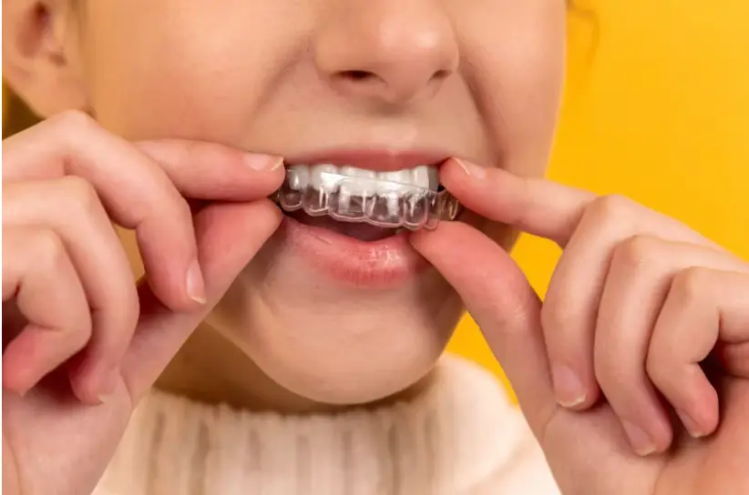 invisalign